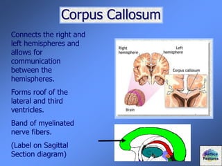 Corpus Callosum
Connects the right and
left hemispheres and
allows for
communication
between the
hemispheres.
Forms roof of the
lateral and third
ventricles.
Band of myelinated
nerve fibers.
(Label on Sagittal
Section diagram) Surface
Features
 