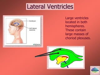 Lateral Ventricles
Large ventricles
located in both
hemispheres.
These contain
large masses of
choriod plexuses.
Ventricles
 