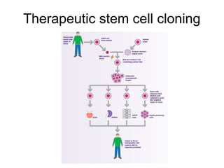 Therapeutic stem cell cloning
 