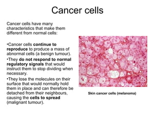 Cancer cells
Cancer cells have many
characteristics that make them
different from normal cells:
•Cancer cells continue to
reproduce to produce a mass of
abnormal cells (a benign tumour).
•They do not respond to normal
regulatory signals that would
instruct them to stop dividing when
necessary.
•They lose the molecules on their
surface that would normally hold
them in place and can therefore be
detached from their neighbours,
causing the cells to spread
(malignant tumour).
Skin cancer cells (melanoma)
 