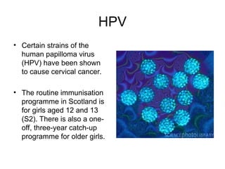 HPV
• Certain strains of the
human papilloma virus
(HPV) have been shown
to cause cervical cancer.
• The routine immunisation
programme in Scotland is
for girls aged 12 and 13
(S2). There is also a one-
off, three-year catch-up
programme for older girls.
 