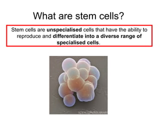 What are stem cells?
Stem cells are unspecialised cells that have the ability to
reproduce and differentiate into a diverse range of
specialised cells.
 