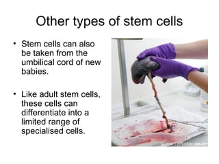 Other types of stem cells
• Stem cells can also
be taken from the
umbilical cord of new
babies.
• Like adult stem cells,
these cells can
differentiate into a
limited range of
specialised cells.
 