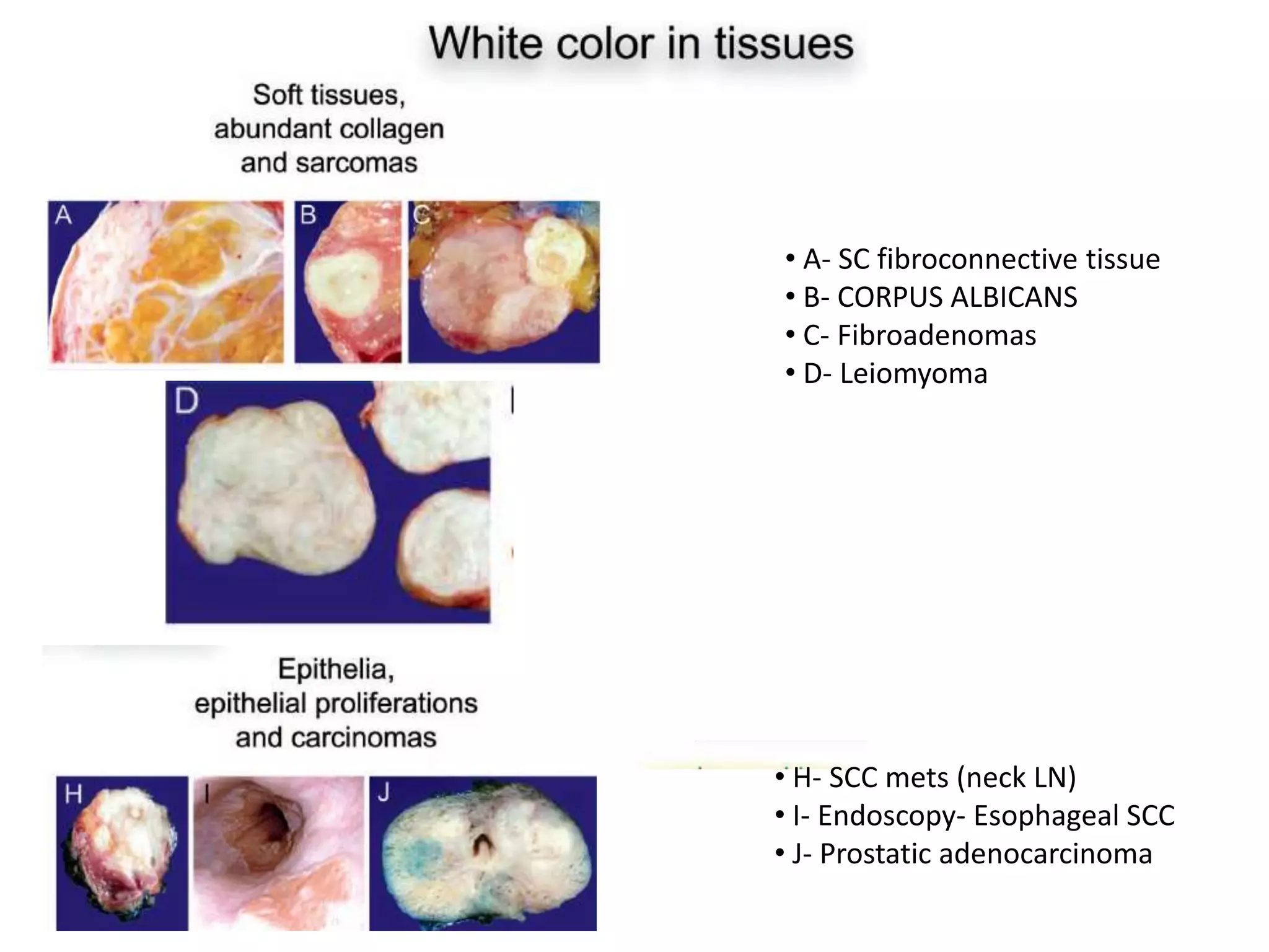 Human colors. color of normal and pathologic tissue | PPTX