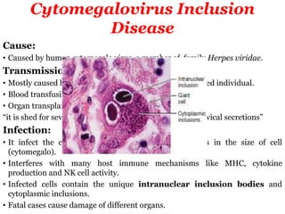 Human contact diseases | PPTX