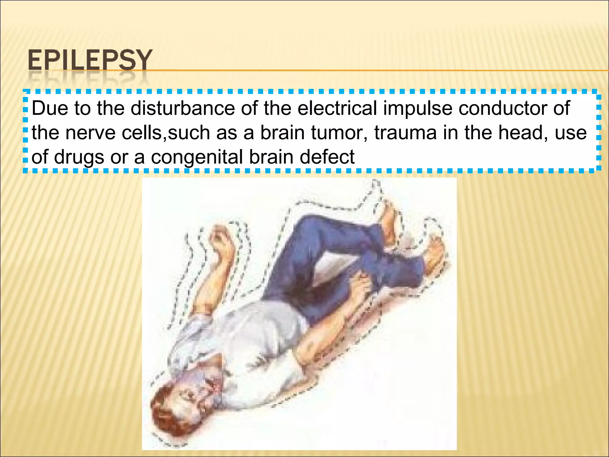 Due to the disturbance of the electrical impulse conductor of
the nerve cells,such as a brain tumor, trauma in the head, use
of drugs or a congenital brain defect