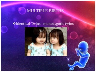 MULTIPLE BIRTHS
Identical Twins– monozygotic twins
 