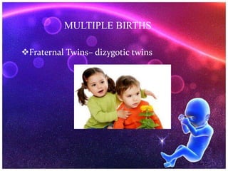 Fraternal Twins– dizygotic twins
MULTIPLE BIRTHS
 