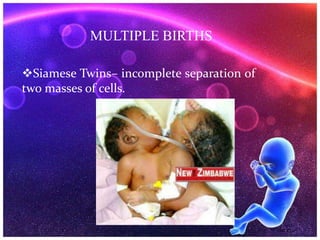 Siamese Twins– incomplete separation of
two masses of cells.
MULTIPLE BIRTHS
 