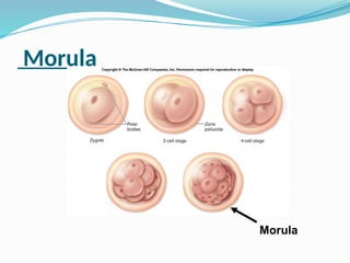 Morula
Morula
 