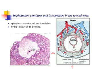Implantation continues and is completed in the second week 
 epithelium covers the endometrium defect 
 by the 12th day of development 
 
 
 