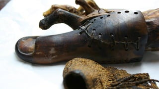 Human enhancement