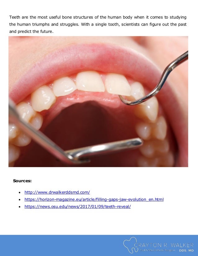 Human Evolution and the Eventual Disappearance of Wisdom Teeth