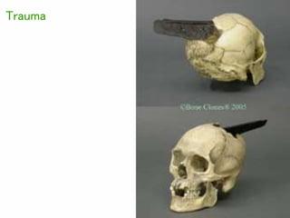 Neanderthals (ca. 100-32 kya)
o Restricted to Europe, eastern Middle East
during Ice Age
o Evolved to be cold-adapted:
– S...