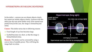 Human eye and colourful world | PPTX