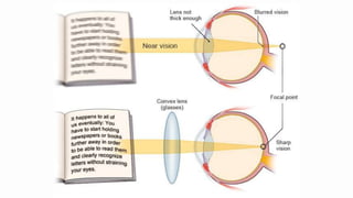 Human eye and colourful world class 10 .pptx