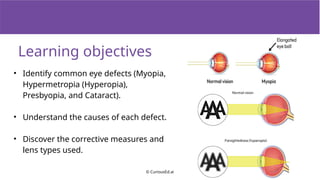 Understanding Common Eye Defects and Their Corrective Measures | PPTX