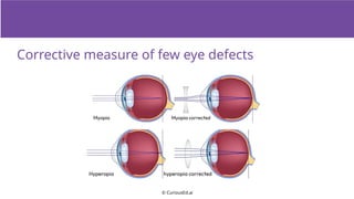 Understanding Common Eye Defects and Their Corrective Measures | PPTX