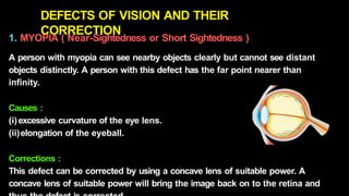 Human Vision Defect Comprehensive Study of the Human Eye, Vision Defects, and Light ...