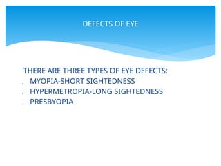 Human Vision Defect Comprehensive Overview of Human Eye Structure and Common Vision Defects ...