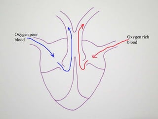 Oxygen poor
blood

Oxygen rich
blood

 