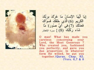 { يَا أَيُّهَا الْإِنسَانُ مَا غَرَّكَ بِرَبِّكَ الْكَرِيمِ  (6)  الَّذِي خَلَقَكَ فَسَوَّاكَ فَعَدَلَكَ  (7)  فِي أَيِّ صُورَةٍ مَّا شَاء رَكَّبَكَ  (8) }  سورة الإنفطار O man! What has made you careless concerning your Lord, the Most Generous ? Who created you, fashioned you perfectly, and gave you due proportion; In whatever form He willed, he put you together.  (Quran. Chap. 82. Vers. 6,7 & 8) 