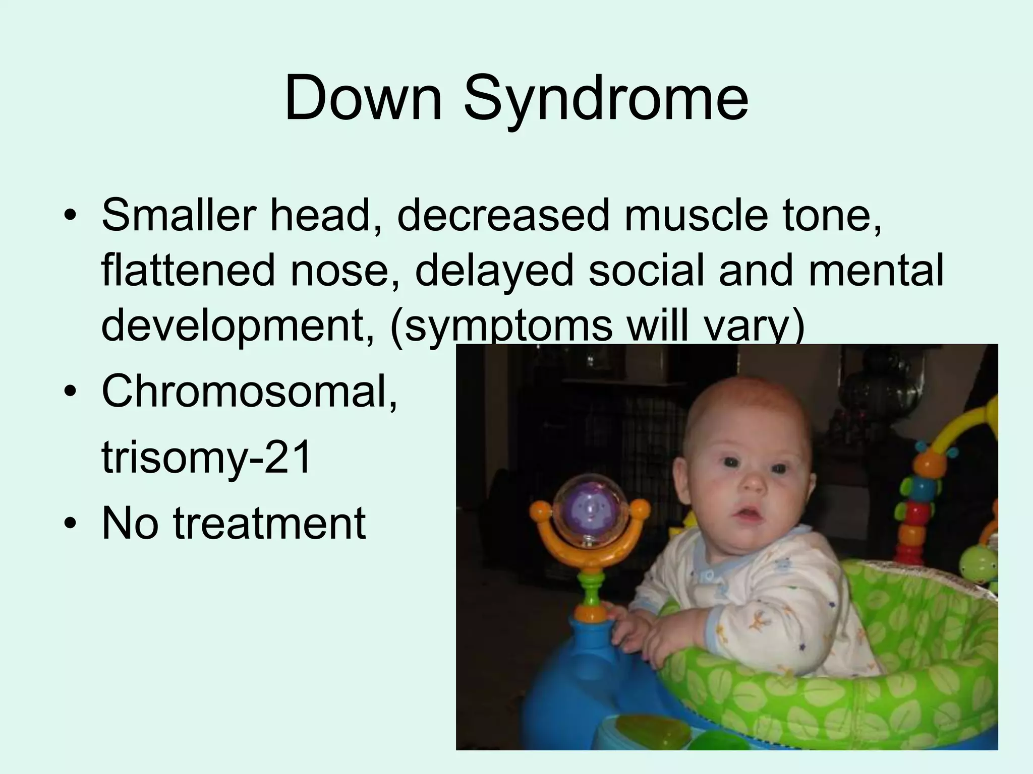 human_genetic_disorders.ppt | Physical Therapy | Wellness