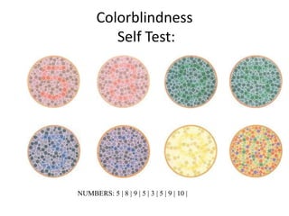 Colorblindness
          Self Test:




NUMBERS: 5 | 8 | 9 | 5 | 3 | 5 | 9 | 10 |
 
