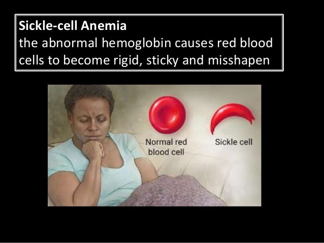 human genomics 2 pedigrees sickle cell genotype chart