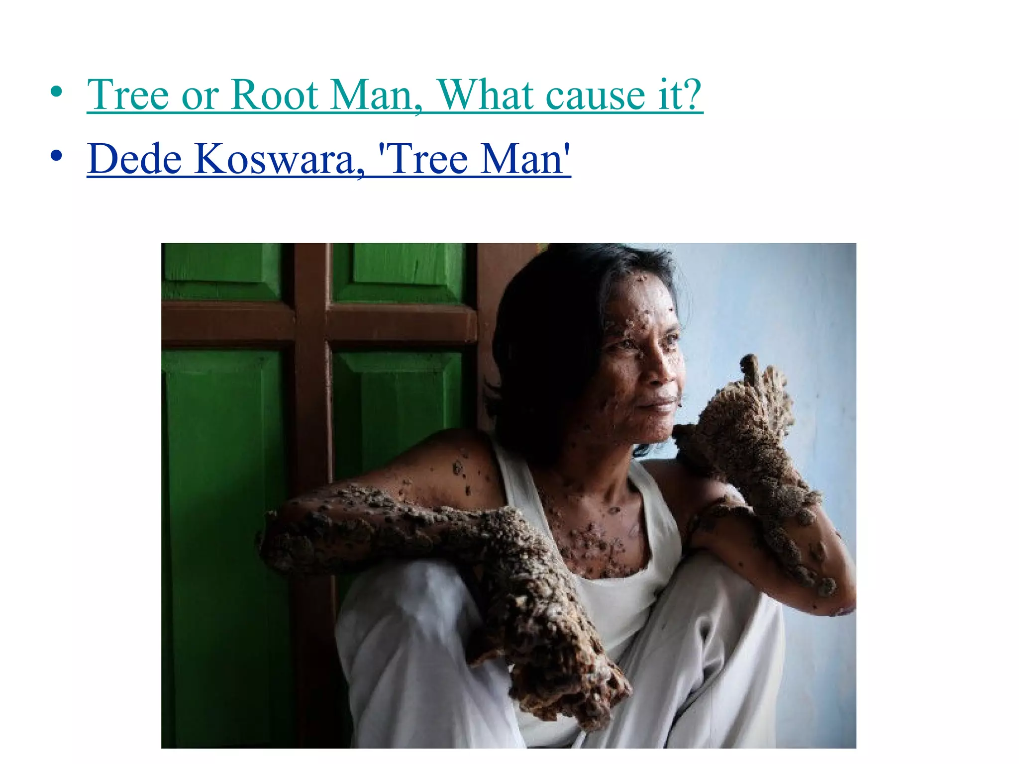 Diagnosed: First Female Case of 'Tree Man Syndrome' | Faculty of Medicine, image size:2048x1536