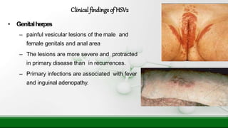 • Genitalherpes
– painful vesicular lesions of the male and
female genitals and anal area
– The lesions are more severe and protracted
in primary disease than in recurrences.
– Primary infections are associated with fever
and inguinal adenopathy.
Clinical findingsof HSV2
 