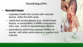 • Neonatalherpes
– originates chiefly from contact with vesicular
lesions within the birth canal.
– varies from severe disease (e.g., disseminated
lesions or encephalitis) to milder local lesions
(skin, eye, mouth) to asymptomatic infection.
– prevented by performing cesarean section on
women with either active lesions or positive viral
cultures.
Clinical findingsof HSV2
 