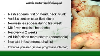 • Rash appears first on head, neck, trunk
• Vesicles contain clear fluid (itch)
• Newvesicles appear during first week
• Mildfever, malaise, headache
• Recovery in 2 weeks
• Adultinfections more severe (pneumonia)
• Neonatal infection(encephalitis)
• Immunosuppressed (severe progressive infection)
Vericellazoastervirus (chickenpox)
 