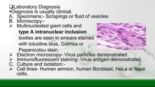 Laboratory Diagnosis
Diagnosis is usually clinical.
A. Specimens:- Scrapings or fluid of vesicles
B. Microscopy:-
 Multinucleated giant cells and
type A intranuclear inclusion
bodies are seen in smears stained
with toluidine blue, Giemsa or
Papanicolou stain.
 Electron microscopy- Virus particles demonstrated
 Immunofluorescent staining- Virus antigen demonstrated
C. Culture and Isolation:-
 Cell lines- Human amnion, human fibroblast, HeLa or Vero
cells.
 