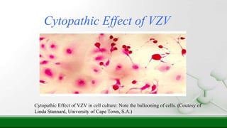 Cytopathic Effect of VZV in cell culture: Note the ballooning of cells. (Coutesy of
Linda Stannard, University of Cape Town, S.A.)
Cytopathic Effect of VZV
 