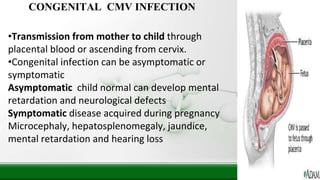 CONGENITAL CMV INFECTION
•Transmission from mother to child through
placental blood or ascending from cervix.
•Congenital infection can be asymptomatic or
symptomatic
Asymptomatic child normal can develop mental
retardation and neurological defects
Symptomatic disease acquired during pregnancy
Microcephaly, hepatosplenomegaly, jaundice,
mental retardation and hearing loss
 