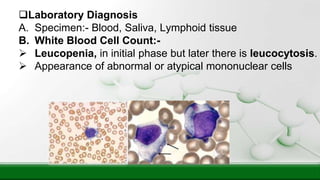 Laboratory Diagnosis
A. Specimen:- Blood, Saliva, Lymphoid tissue
B. White Blood Cell Count:-
 Leucopenia, in initial phase but later there is leucocytosis.
 Appearance of abnormal or atypical mononuclear cells
 