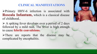CLINICAL MANIFESTATIONS
Primary HHV-6 infection is associated with
Roseala Infantum, which is a classical disease
of childhood..
 A spiking fever develops over a period of 2 days
followed by a mild rash. The fever is high enough
to cause febrile convulsions.
There are reports that the disease may be
complicated by encephalitis.
 