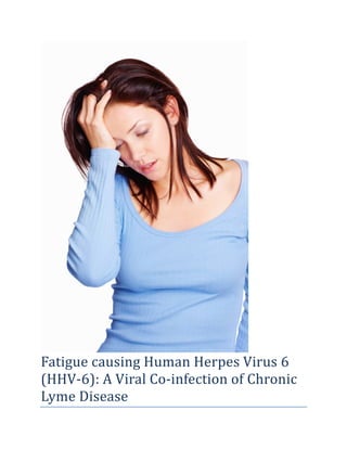 Fatigue causing Human Herpes Virus 6
(HHV-6): A Viral Co-infection of Chronic
Lyme Disease
 