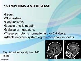6.SYMPTOMS AND DISEASE
Fever.
Skin rashes.
Conjunctivitis.
Muscle and joint pain.
Malaise or headache.
These symptoms normally last for 2-7 days.
Affects nervous system eg:microcephaly in foetus.
Fig : 6.1 microcephaly head IMR
image
 