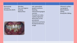 `wwwww
Nectrotizing
Ulcerative
Periodontitis (NUP)
Microbes
Poor oral hygiene
Smoking
Malnutrition
pain, generalized
gingival erythema
bleeding,
interproximal gingival
necrosis,
Punched out crater,
rapidly progressive
destruction of the
periodontal
attachment and bone
Psuedomembranous
slough
Ultrasonic scaling –
supragingival
Metronidazole
250mg
Amoxycillin 500mg
 