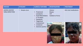 DISEASE ETIOLOGY CLINICAL FEATURES INVESTIGATION TREATMENT
HERPES ZOSTER
VIRUS INFECTION
• Herpes virus
• Prodromal
symptoms
• Fluid filled blisters
(7-10 days)
• Headache
• Trigeminal
involvement
• Unilateral
• Extreme painful
History
Biopsy
CSF
Isolation of virus
Anti viral medications
 