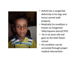 • Ashish has a congenital
  deformity in his legs and
  hence cannot walk
  properly.
• Medically his condition is
  known as Congenital
  Tallip Equano Varus(CTEV)
• He is six years old and
  goes to the little flower
  school.
• His condition can be
  corrected through proper
  medical intervention
 