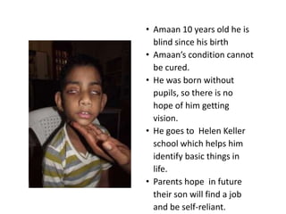 • Amaan 10 years old he is
  blind since his birth
• Amaan’s condition cannot
  be cured.
• He was born without
  pupils, so there is no
  hope of him getting
  vision.
• He goes to Helen Keller
  school which helps him
  identify basic things in
  life.
• Parents hope in future
  their son will find a job
  and be self-reliant.
 