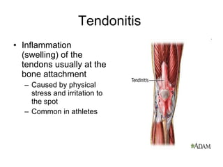 Tendonitis Inflammation (swelling) of the tendons usually at the bone attachment Caused by physical stress and irritation to the spot Common in athletes