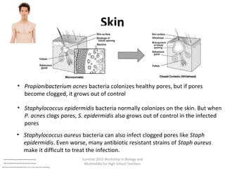 Summer 2012 Workshop in Biology and
Multimedia for High School Teachers
Skin
http://commons.wikimedia.org/wiki/File:Anterior_view_of_male_upper_body,_retouched.jpg
http://microbewiki.kenyon.edu/index.php/File:Lesionsclosed.jpg
http://microbewiki.kenyon.edu/index.php/File:Lesionsmicro.jpg
• Propionibacterium acnes bacteria colonizes healthy pores, but if pores
become clogged, it grows out of control
• Staphylococcus epidermidis bacteria normally colonizes on the skin. But when
P. acnes clogs pores, S. epidermidis also grows out of control in the infected
pores
• Staphylococcus aureus bacteria can also infect clogged pores like Staph
epidermidis. Even worse, many antibiotic resistant strains of Staph aureus
make it difficult to treat the infection.
 