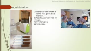 Administration
European consensus conference on FMT in clinical practice
(A)Donor stool and normal
saline (1:3) ground in a
blender.
(B)Fecal suspension in 50-mL
syringes.
(C)Infusion using
colonoscopy.
 