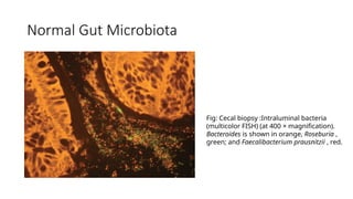 Normal Gut Microbiota
Fig: Cecal biopsy :Intraluminal bacteria
(multicolor FISH) (at 400 × magnification).
Bacteroides is shown in orange, Roseburia ,
green; and Faecalibacterium prausnitzii , red.
 