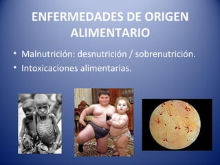 ENFERMEDADES DE ORIGEN
ALIMENTARIO
• Malnutrición: desnutrición / sobrenutrición.
• Intoxicaciones alimentarias.
 