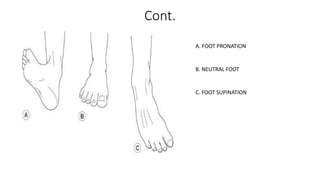 Cont.
A. FOOT PRONATION
B. NEUTRAL FOOT
C. FOOT SUPINATION
 